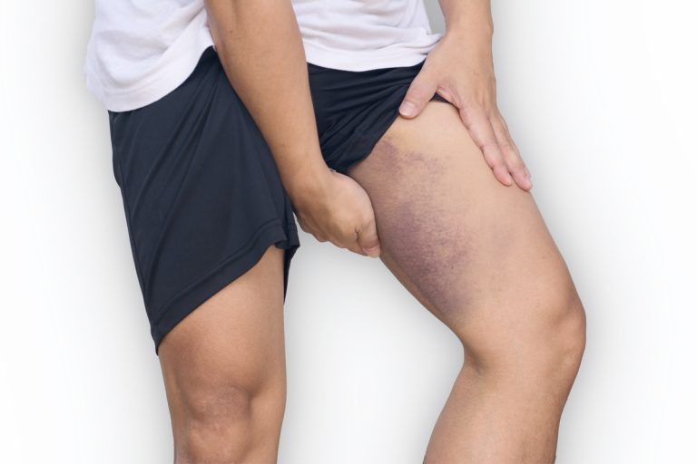 Pain in the groins – how to get rid of it?