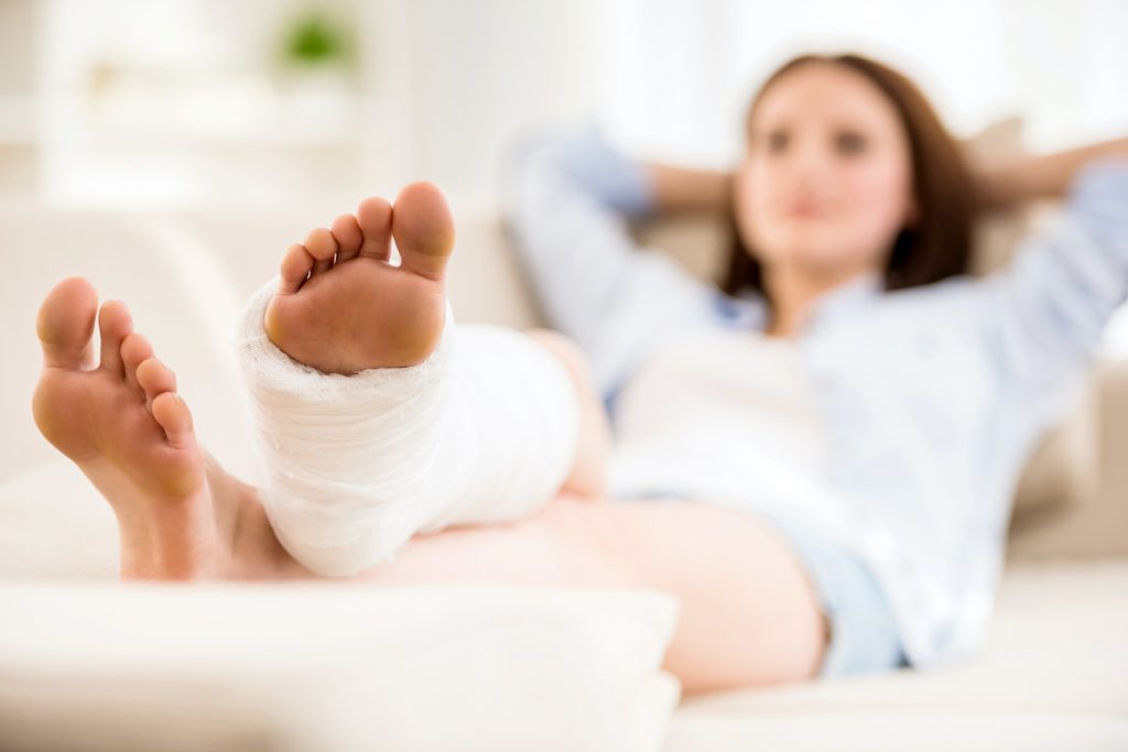 R.I.C.E. (Rest, Ice, compression, elevation)